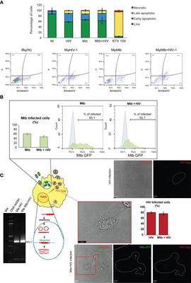 Modulation of Cystatin C in Human Macrophages Improves Anti-Mycobacterial Immune Responses to Mycobacterium tuberculosis Infection and Coinfection With HIV